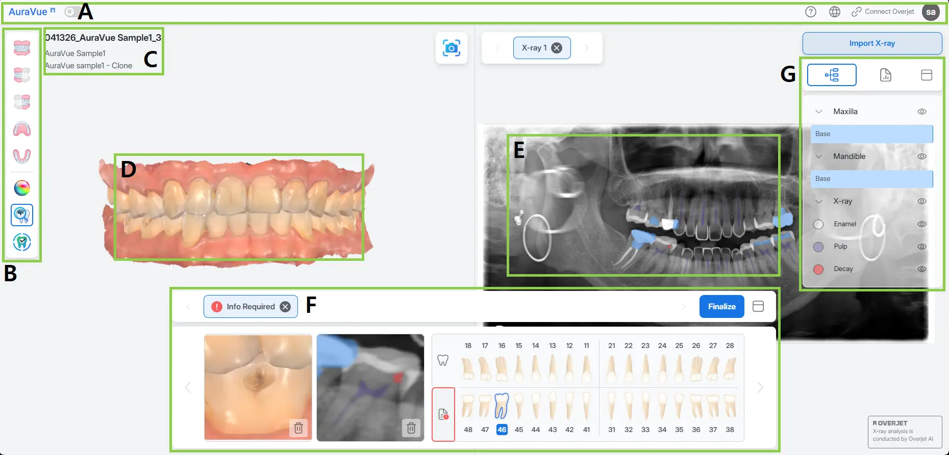 AuraVue User Interface.webp
