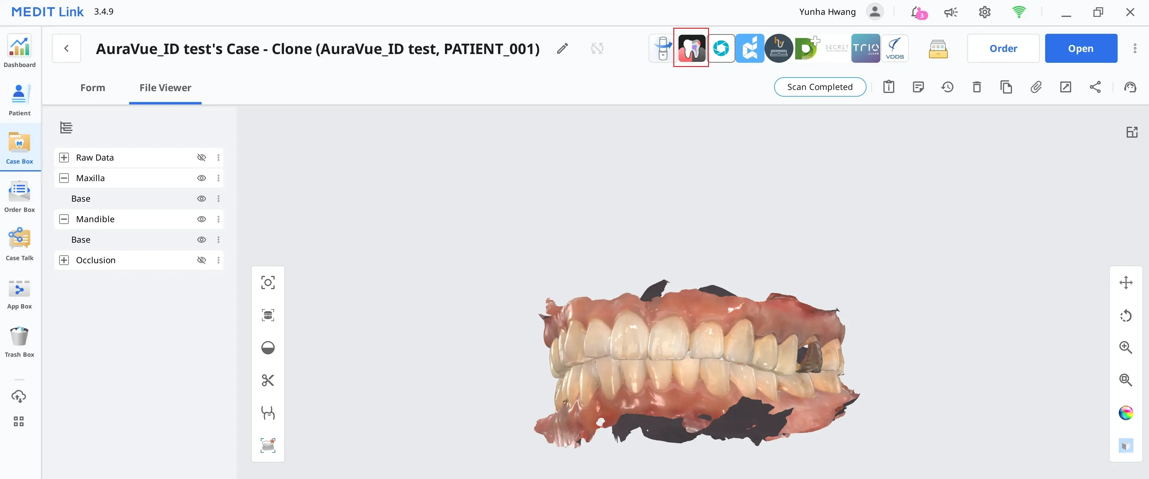 Auravue 1.webp