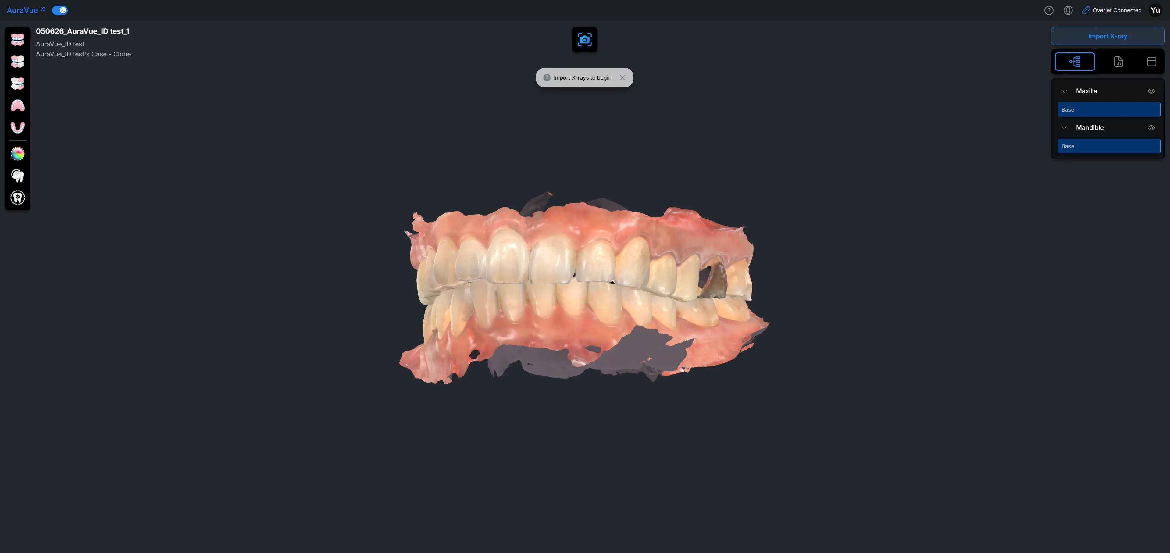 AuraVue_3.webp