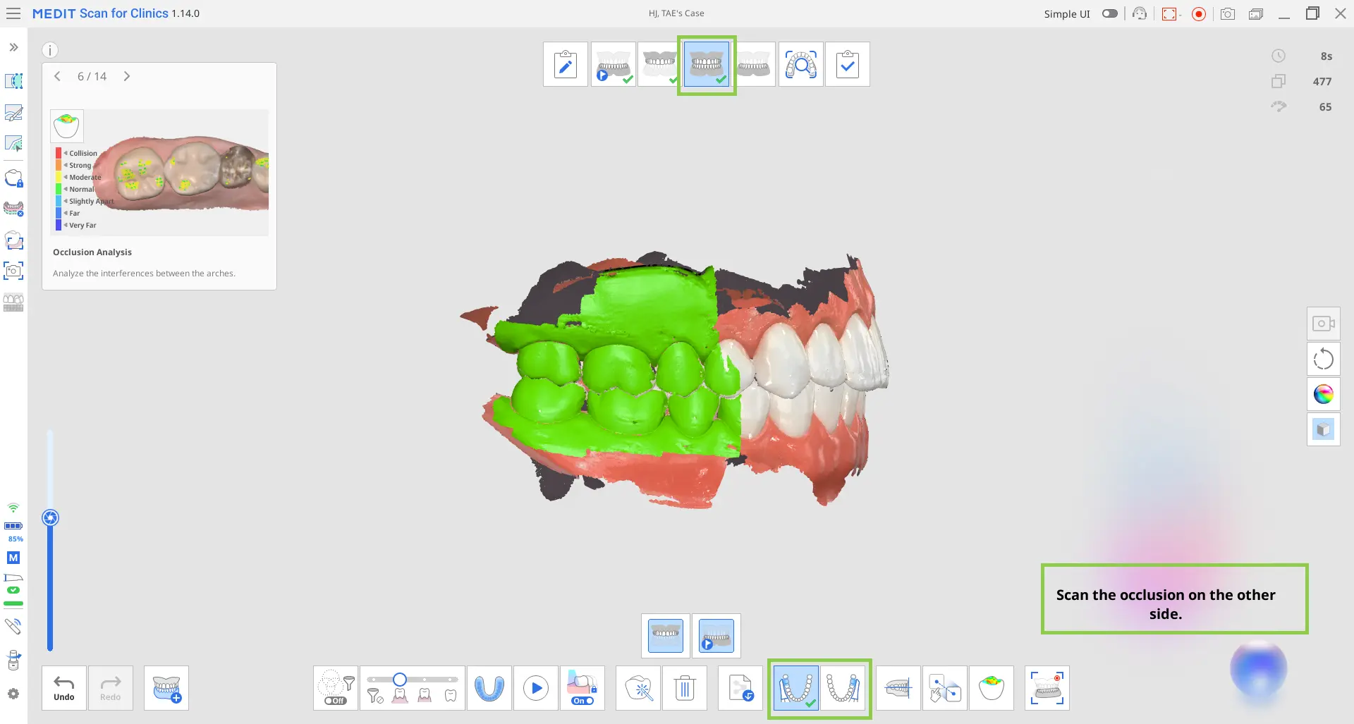 Acquiring the occlusion data.webp