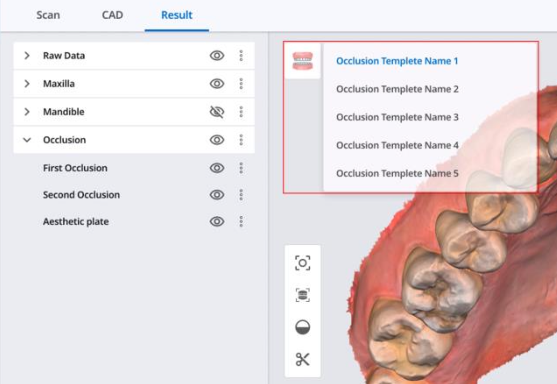 Multi occlusion data management Medit Help Center