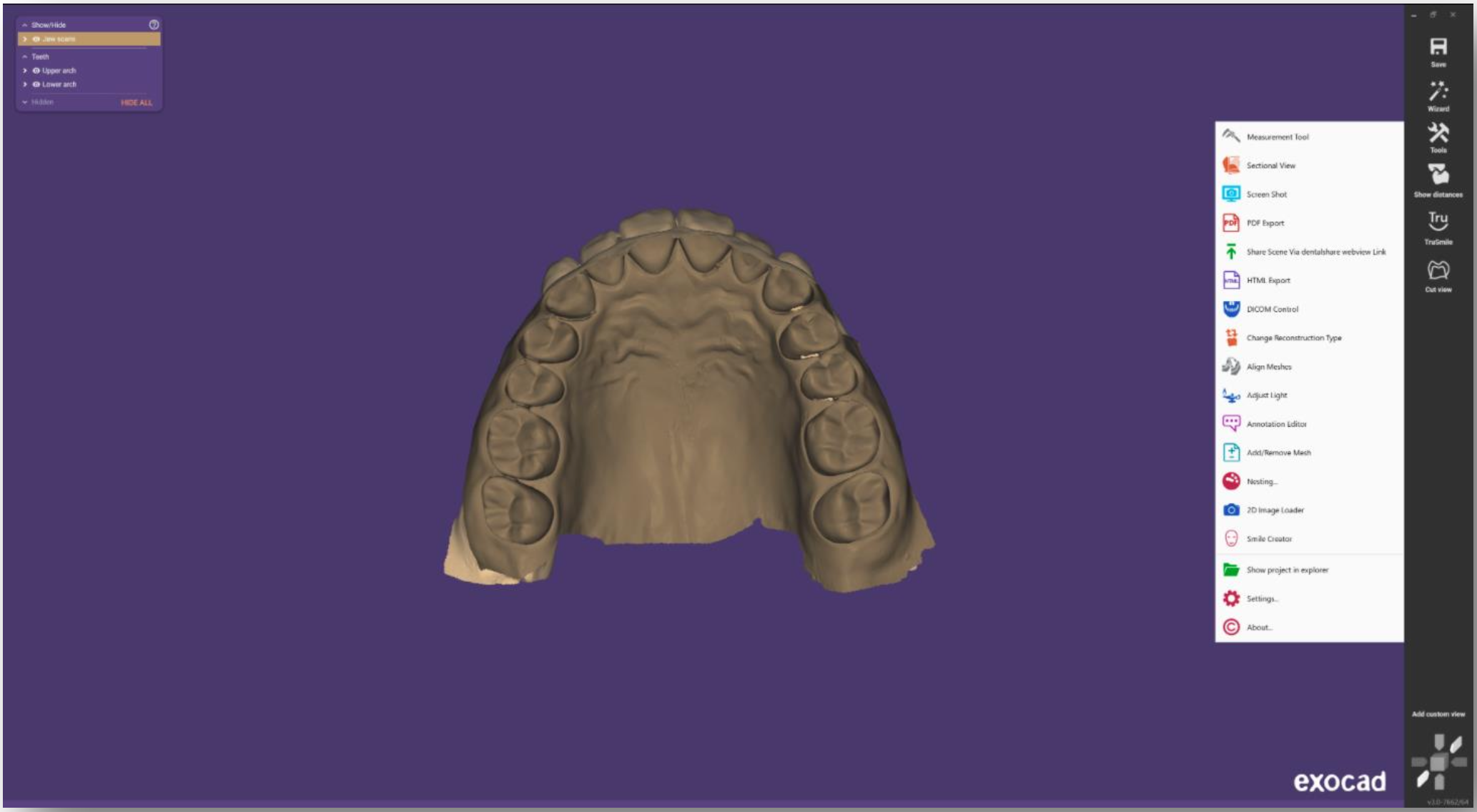 5_multi_occlusion.png