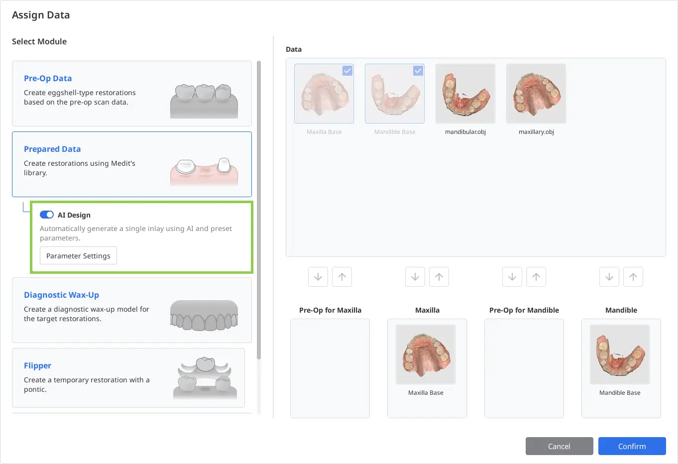 AI Design for Single Inlays.webp