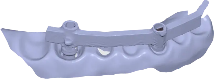 Metal scan 5.webp