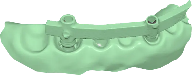 Metal scan 4.webp