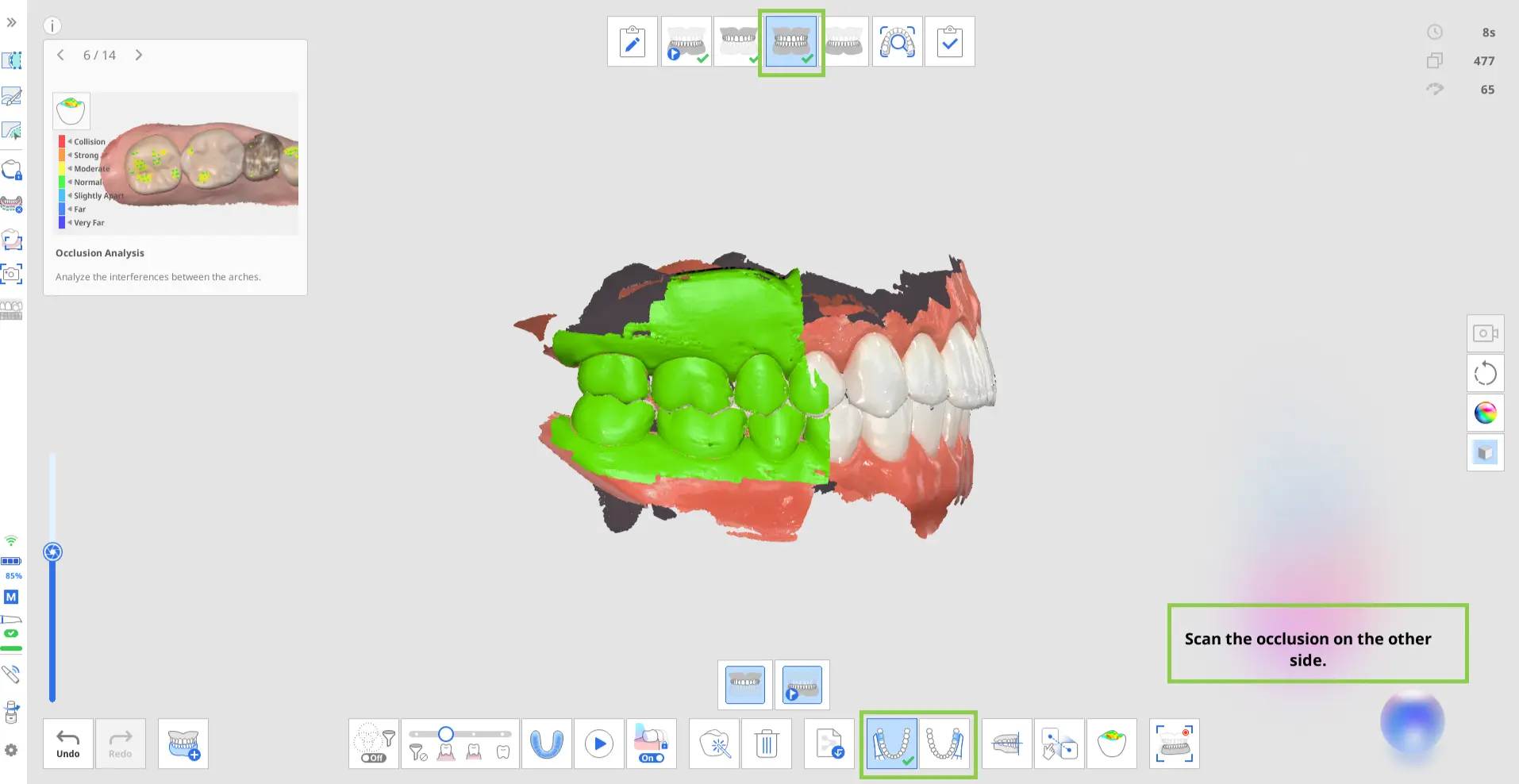 Acquiring the occlusion data (1).webp