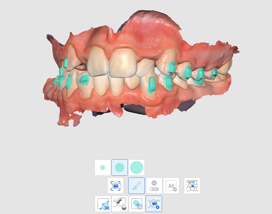 attachment removal(1).png