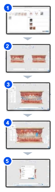vertical_steps_5.png
