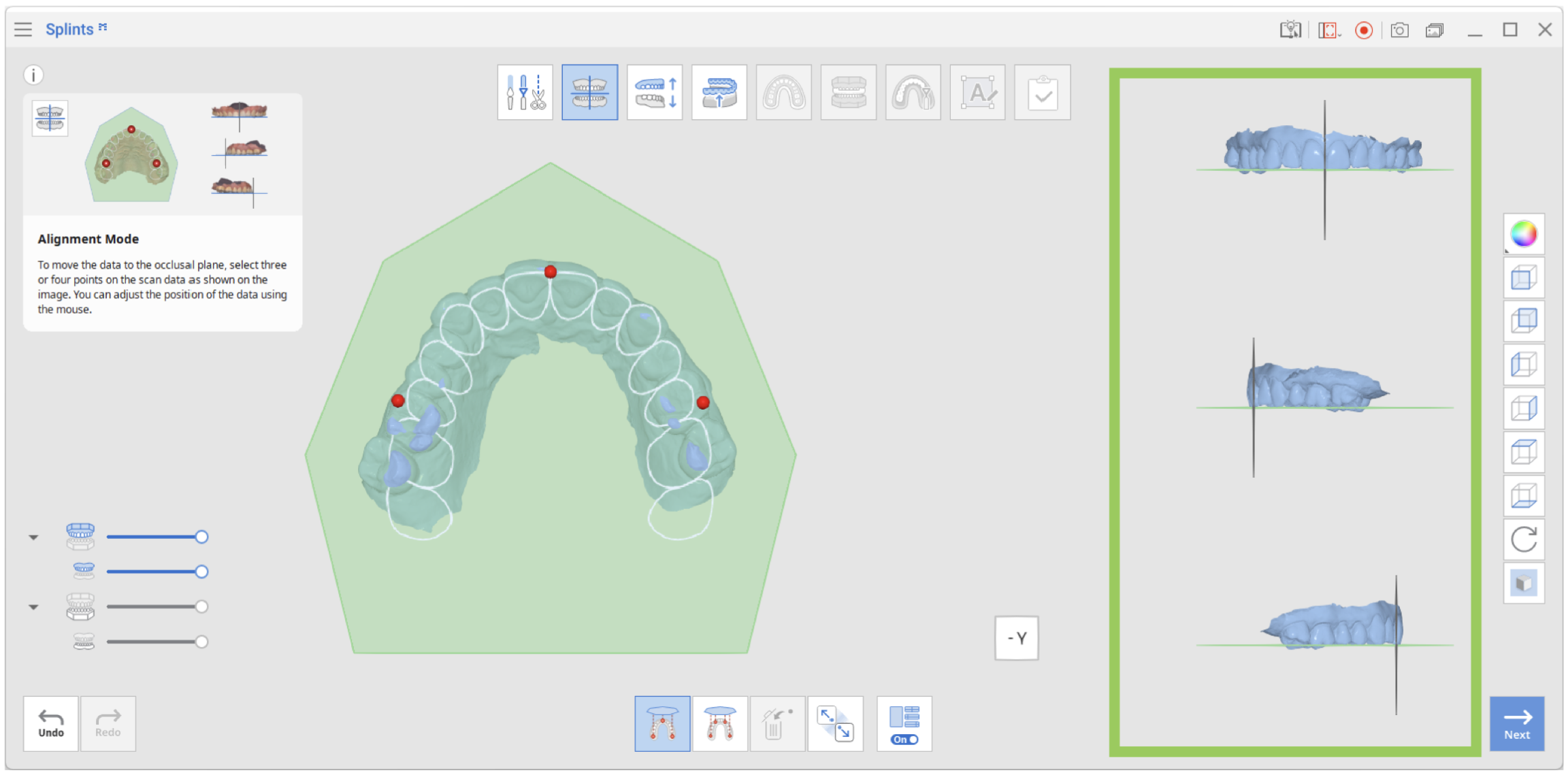 Mode > Alignment – Medit Help Center