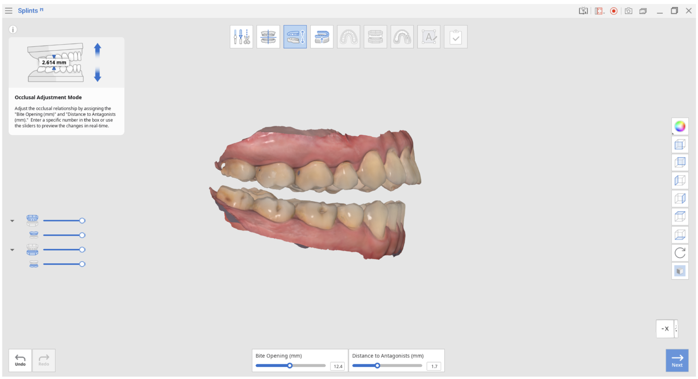 Mode > Occlusal alignment Medit Help Center