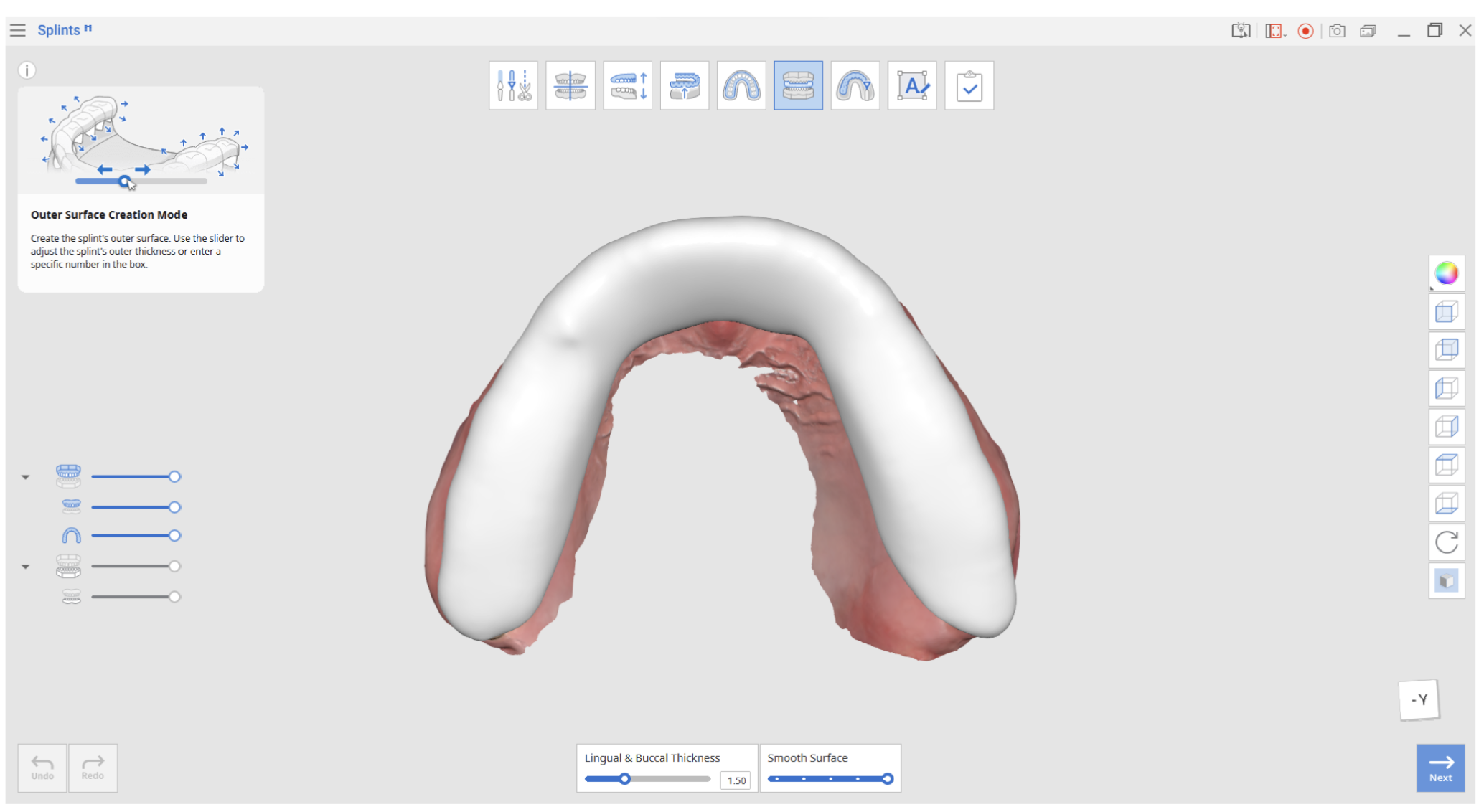 Mode > Outer surface creation – Medit Help Center