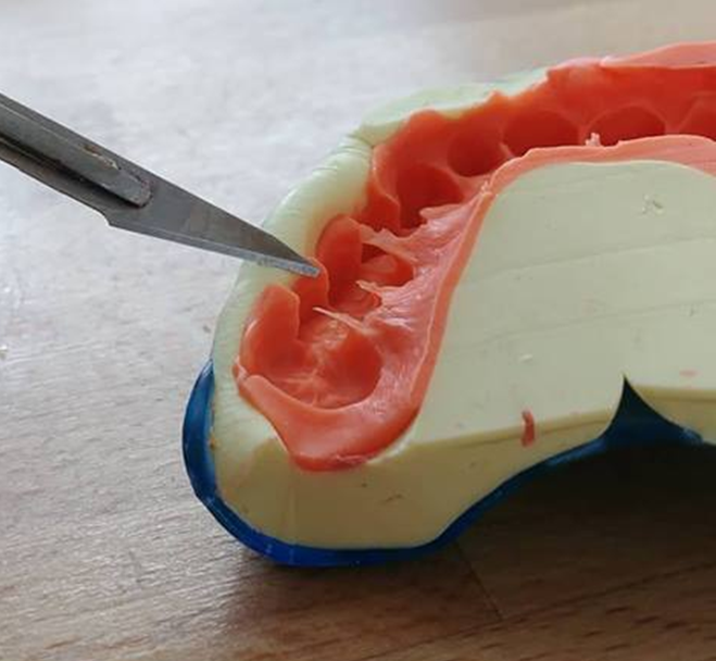 Können Bei Einem Zahnabdruck Die Zähne Mit Herausgezogen Werden Vorschläge zum Scannen der Vorderseite eines Zahnabdrucks – Medit Help